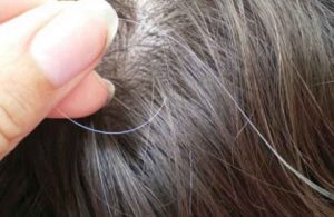 Tóc bạc gây mất thẩm mỹ và ảnh hưởng sức khỏe mái tóc