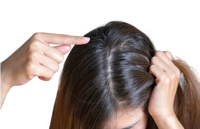 Nhuộm tóc có thể gây nhiều hệ lụy với sức khỏe